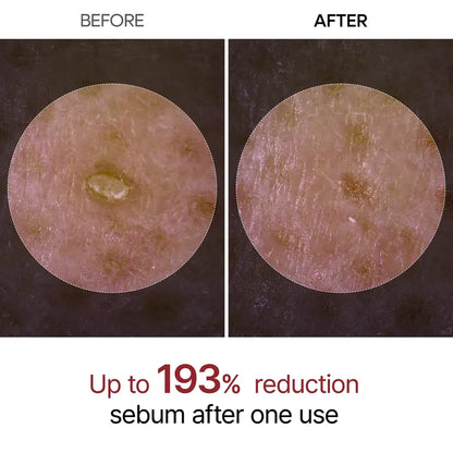 Dr. Melaxin - Peel Shot Exfoliant Black Rice Ampoule