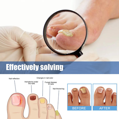 Fungus Nail Repair Patches 60pcs