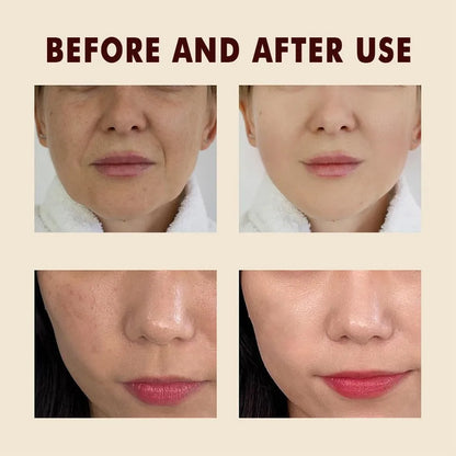 Dr. Melaxin - Peel Shot Exfoliant Black Rice Ampoule